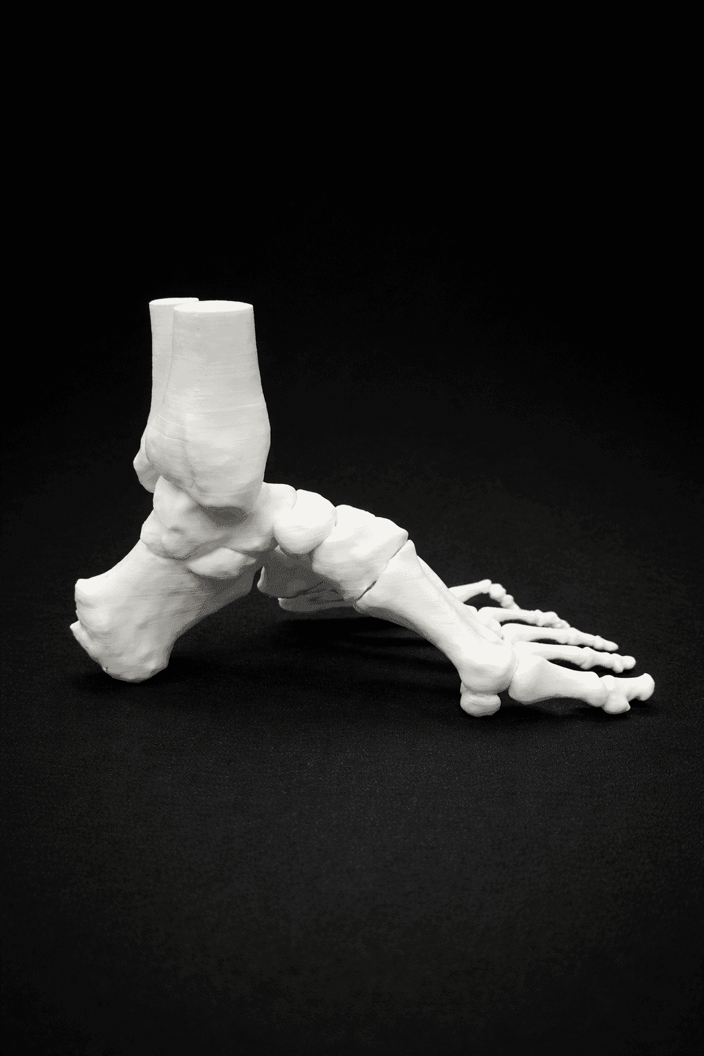 Pes Cavus – Bone Model