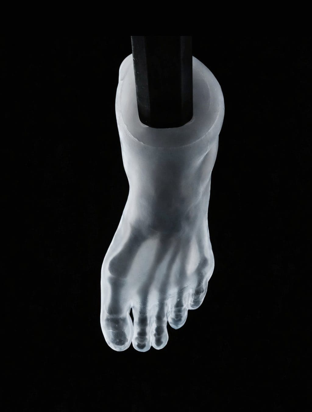Pes Cavus – Transparent Skin – Radioopaque Black Bone