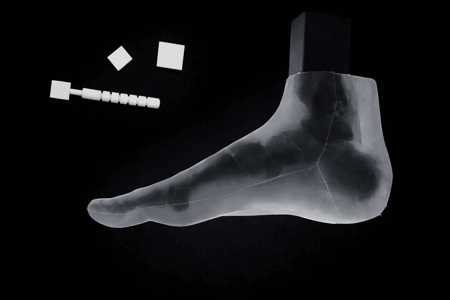 Pes Planus – Transparent Skin – Radiolucent Black Bone – Mobile Joints (including Evans & Cotton wedges)