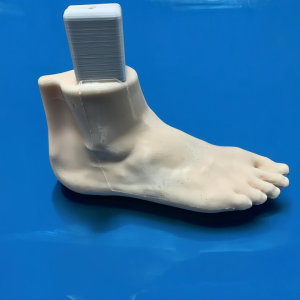 Flat Feet (Pes Planus)