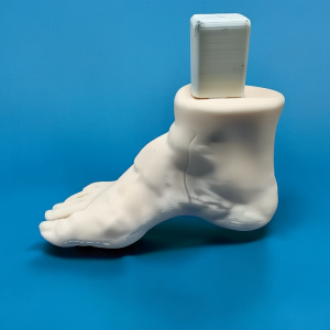 Pes cavus