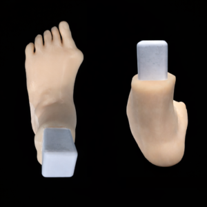 2 Pathology in 1 Foot - Hallux Valgus & Pes Planus - Radioopaque Bone - Opaque Skin - Mobile Joints