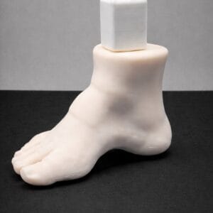 Pes Cavus - Radioopaque Bone - Opaque Skin