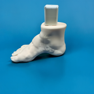 Pes Cavus 2