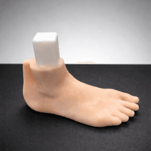 Pes Planus - Radioopaque Bone - Opaque Skin