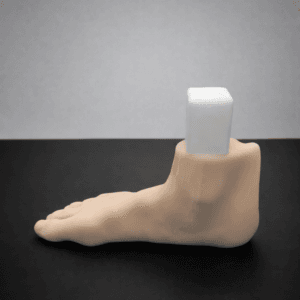 Pes Planus - Radioopaque Bone - Opaque Skin