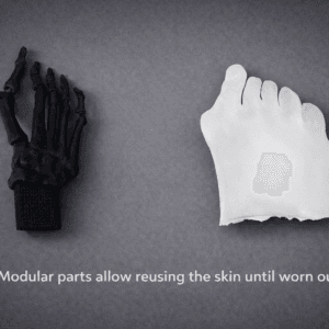 Hallux Valgus - Transparent Skin - Radioopaque Black Bone - Mobile Joints