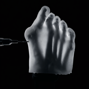 Hallux Valgus - Transparent Skin - Radioopaque Black Bone