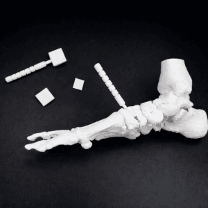 Pes Planus - Bone Model - Mobile Tarsal Joints  (including Evans & Cotton wedges)