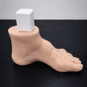 Pes Cavus - Radioopaque Bone - Opaque Skin