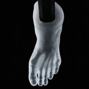 Pes Cavus - Transparent Skin - Radioopaque Black Bone