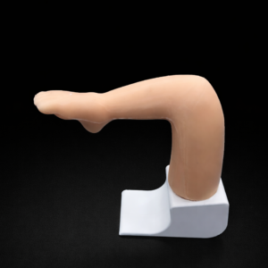 Club Foot (Pes Equinovarus) - Partially Corrected