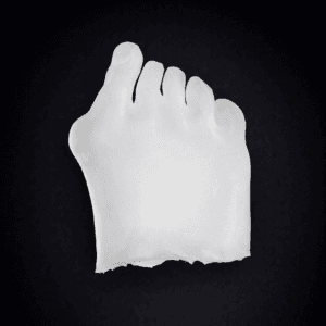 Modular Skin Part Compatible with Hallux Valgus Bone Model (Transparent)