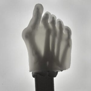 Hallux Valgus - Transparent Skin - Radioopaque White Bone