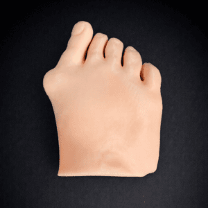 Modular Skin Part Compatible with Hallux Valgus Bone Model (Opaque)