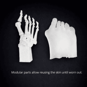 Hallux Valgus - Transparent Skin - Radioopaque White Bone - Mobile Joints