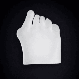Modular Skin Part Compatible with Hallux Valgus Bone Model (Transparent)